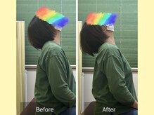 ナオル整体 大宮院(NAORU整体)/あなたの首の動きはどれくらい？