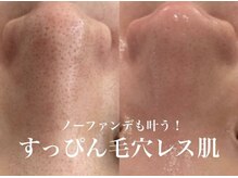 サロン ウーカ(salon WOOCA)/REVI陶肌トリートメント