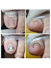 爪切り屋 足楽/