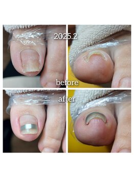 爪切り屋 足楽/