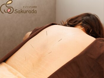 サクラダ治療室 東十条院の写真/【妊活と美を兼ねる総合サロン】高技術×癒しをご提供★あなたのお悩み改善のお手伝いをいたします♪