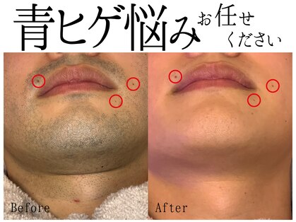 スポット 薬院駅前店(SPOT)の写真