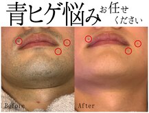 スポット 薬院駅前店(SPOT)