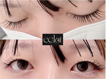 エクラ(eclat)/アンドヘルシー140本