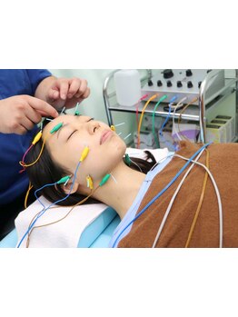 小顔になりたい