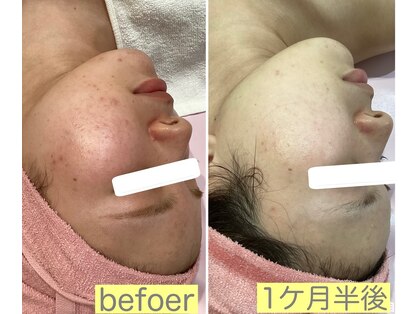 ロゼブランシュ(Rose Blanche)の写真