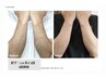 【メンズ】腕全体￥7.500