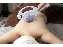 ジョイアエテルナ(gioia eterna)/背中脱毛（背中上下・ヒップ）