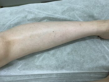 ナノハナ/鹿沼市の全身脱毛美容室ナノハナ