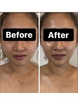 小顔コルギサロン シー(She)/【コルギ】1度の変化!