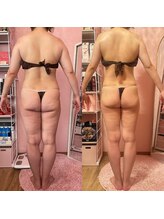 ポノ(Pono)/【痩身】背中美人