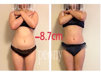 ピオニー(PEONY)/ブライダルにも◎【痩身】上半身