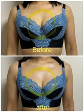 ベッピン(Beppin)/産後のサイズダウン/バストケア