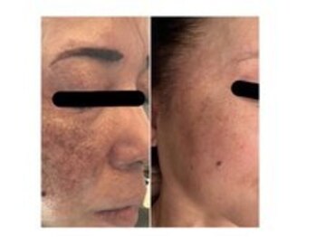 アマラ(Amarra)/お肌のトラブル改善にもおすすめ