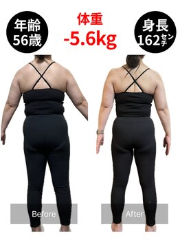 アネモネ/ダイエット/痩身/耳つぼ/腸活