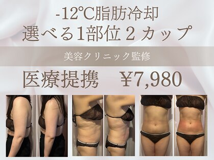 モテスリムの写真