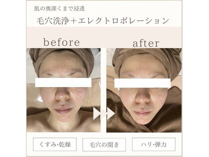 ミレア(Mirea)の写真