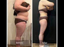 グラシアス サロン(GRACIAS SALON)/人気NO1ガッツリ痩身エステ