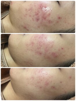 リノ(Lino)/プラズマニア