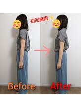 ハレソラ(HareSora)/骨盤矯正ビフォーアフター