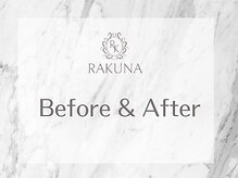 ラクナ(RAKUNA)/ビフォーアフター
