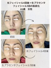 ネリネ(Nerine)/ノーファンデに自信が持てる！