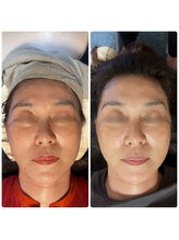 ステラ 武蔵小杉(Stella)/プラズマ B/A