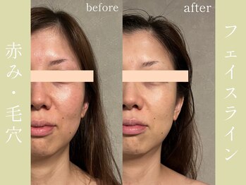 健志接骨院/πテラピー造顔メソッド