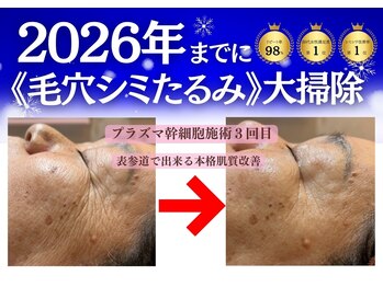 エー プラス リラボ(A plus Relab)