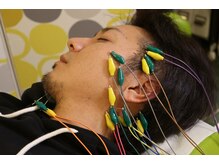 セットアップ鍼灸院(setup鍼灸院)/lift up美容鍼