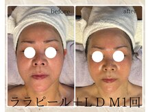 サロン ド ボーテ ラーンジュ 岐阜店(salon de beaut'e L'ange)/ララピール＆ＬＤＭ