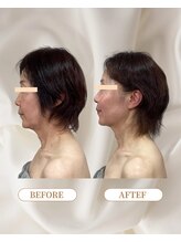 トロワ(TROIS)/横顔に自信が持てる