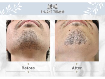 エムプラス 東戸塚(M+)/before/after