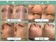 ベストベル(BestBelle)の写真