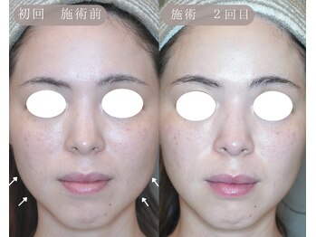 岩川治療院/ハイブリッド&シュープリーム