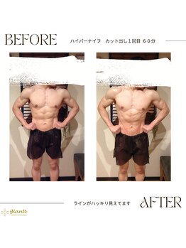 グランツ 小山店/カットだしのお客様　施術１回目