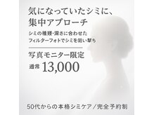 ジオリッチシフォン(giorich chiffon)の雰囲気（シミ改善/シミケアエステのお写真モニター大募集★）