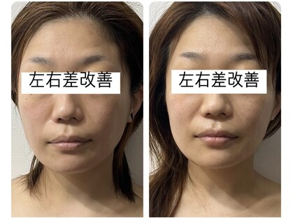 ベルファム(Belle femme)の写真