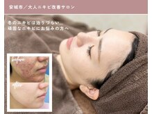 エピア 三河安城店(Epia)