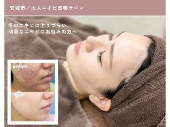 エピア 三河安城店(Epia)