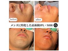 モンド(Mondo)の雰囲気（【完全個室のプライベートサロン】完全予約制・夜22時まで営業）