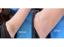 リピア リノ 千葉店(L'PUR L'no)/【新メニュー開始★】L‘PURPINK