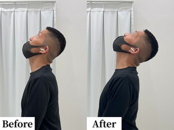 ソレア(Solea)/首こり・肩こり・足の重だるさ