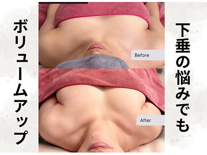 ボニービューティー(Bony Beauty)の写真