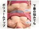 ボニービューティー(Bony Beauty)の写真