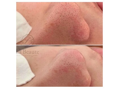 サロン エルピナ(salon ELPINA)の写真