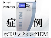 サロンヴェアリー 広尾(salon vary)/恵比寿広尾水玉リフティングLDM