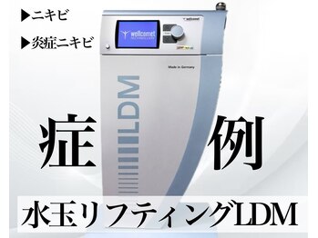 サロンヴェアリー 広尾(salon vary)/恵比寿広尾水玉リフティングLDM