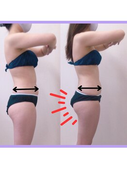 ピアリーノ(Pialino)/たった1回！ビフォーアフター