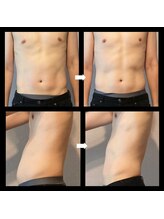 伊達男/フォースカッター 事例